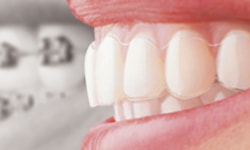 004積み重ねができる椅子